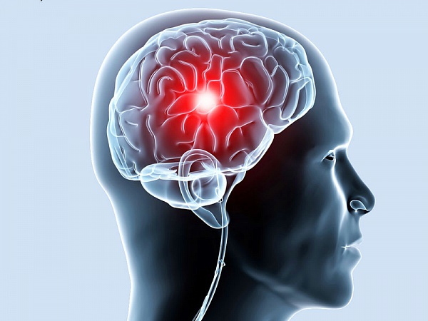 Ишемия головного мозга: лечение и симптомы