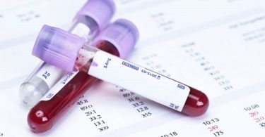 Зачем сдают анализ на антитела при беременности?