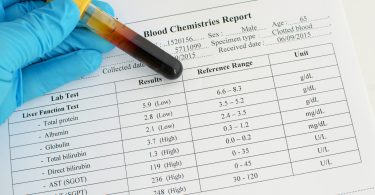 Как нормализовать уровень билирубина в крови?