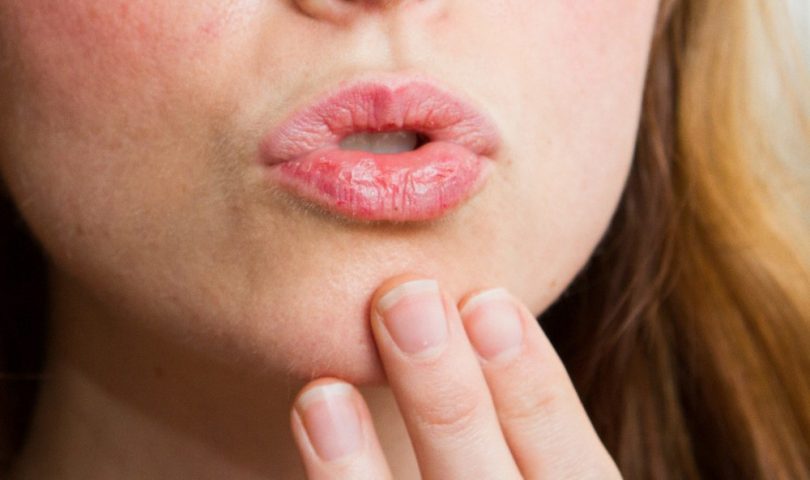 Сухость во рту - причины какой болезни?