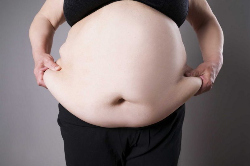 Висцеральное ожирение (у женщин, мужчин): лечение, диета